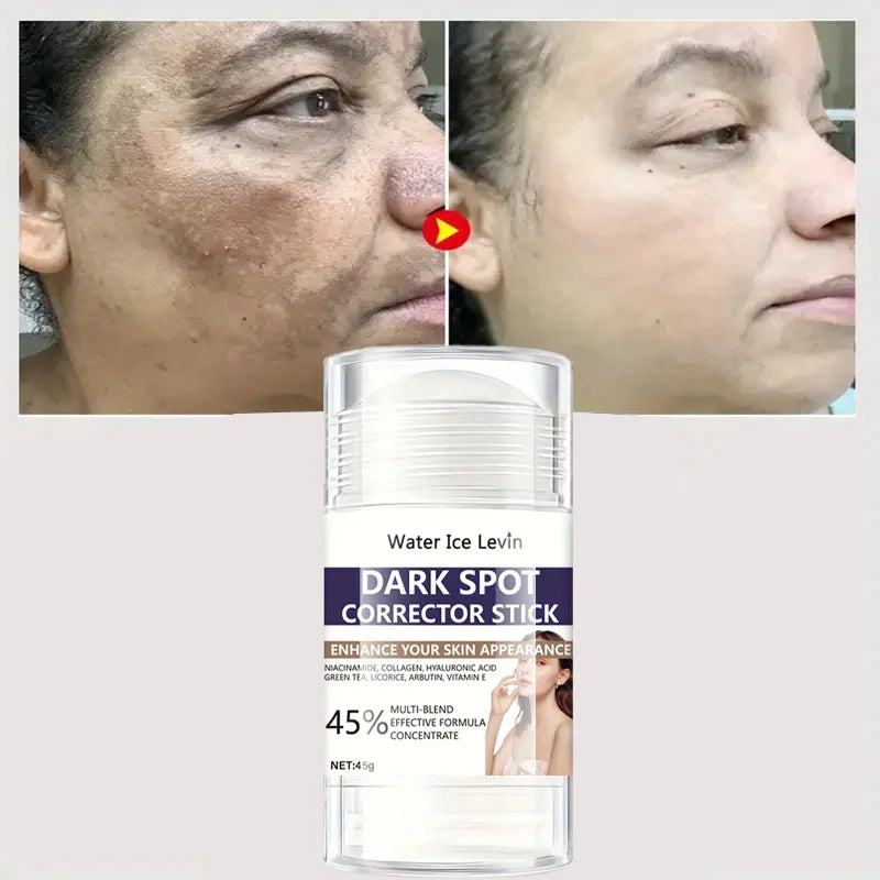 Dark Spot Correction Stick Anti-Wrinkle Firming Elasticity Improvement Loose Skin Lotion Moisturizes and brightens skin